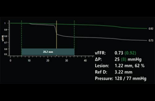 caas-vvfr-residual-pressure